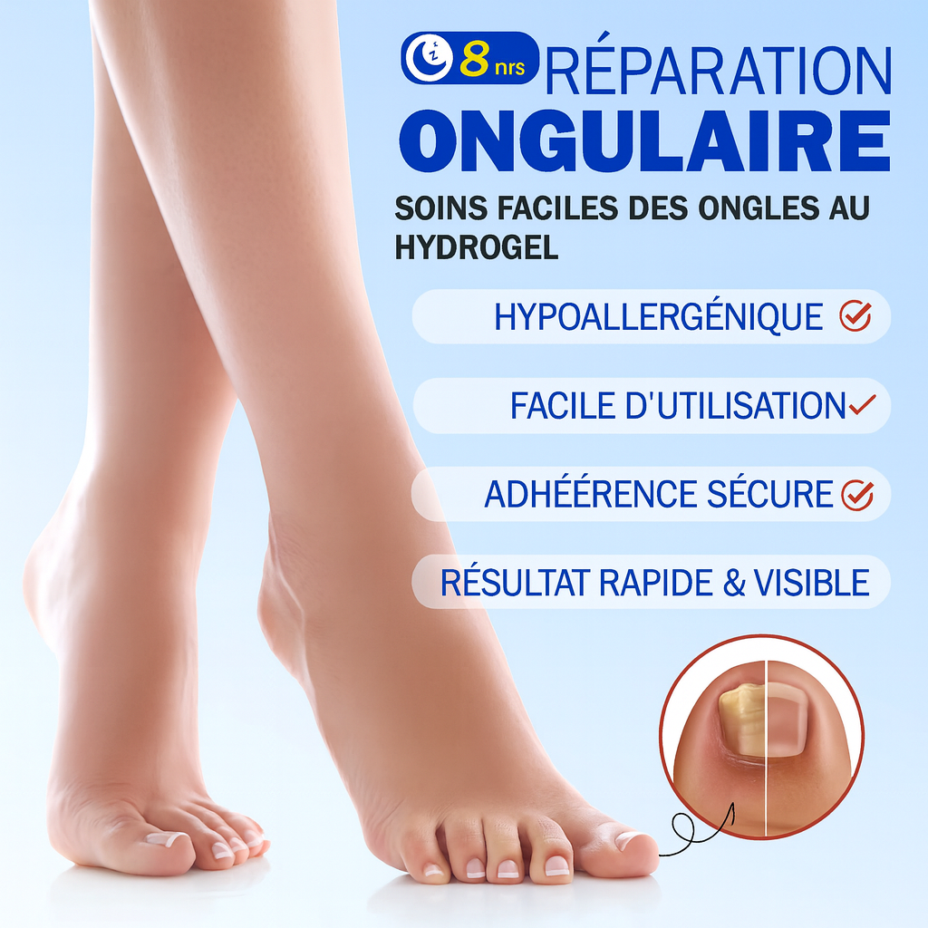 OngleFix-réparation ongles